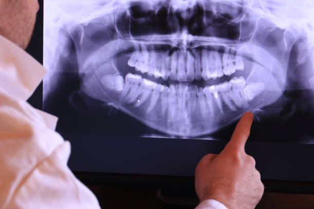 Best Emergency Tooth Extraction in Shenandoah, LA