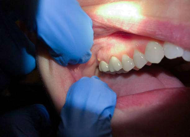 Best Weekend Emergency Dentist in Shenandoah, LA